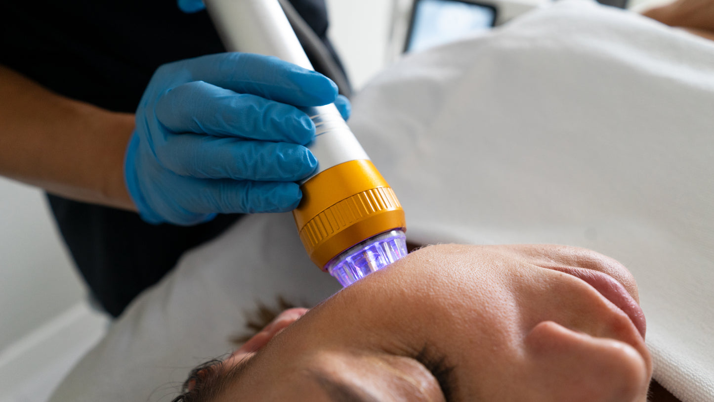 Frax RF – mikronakłucia z falą radiową dla spektakularnego odmłodzenia skóry