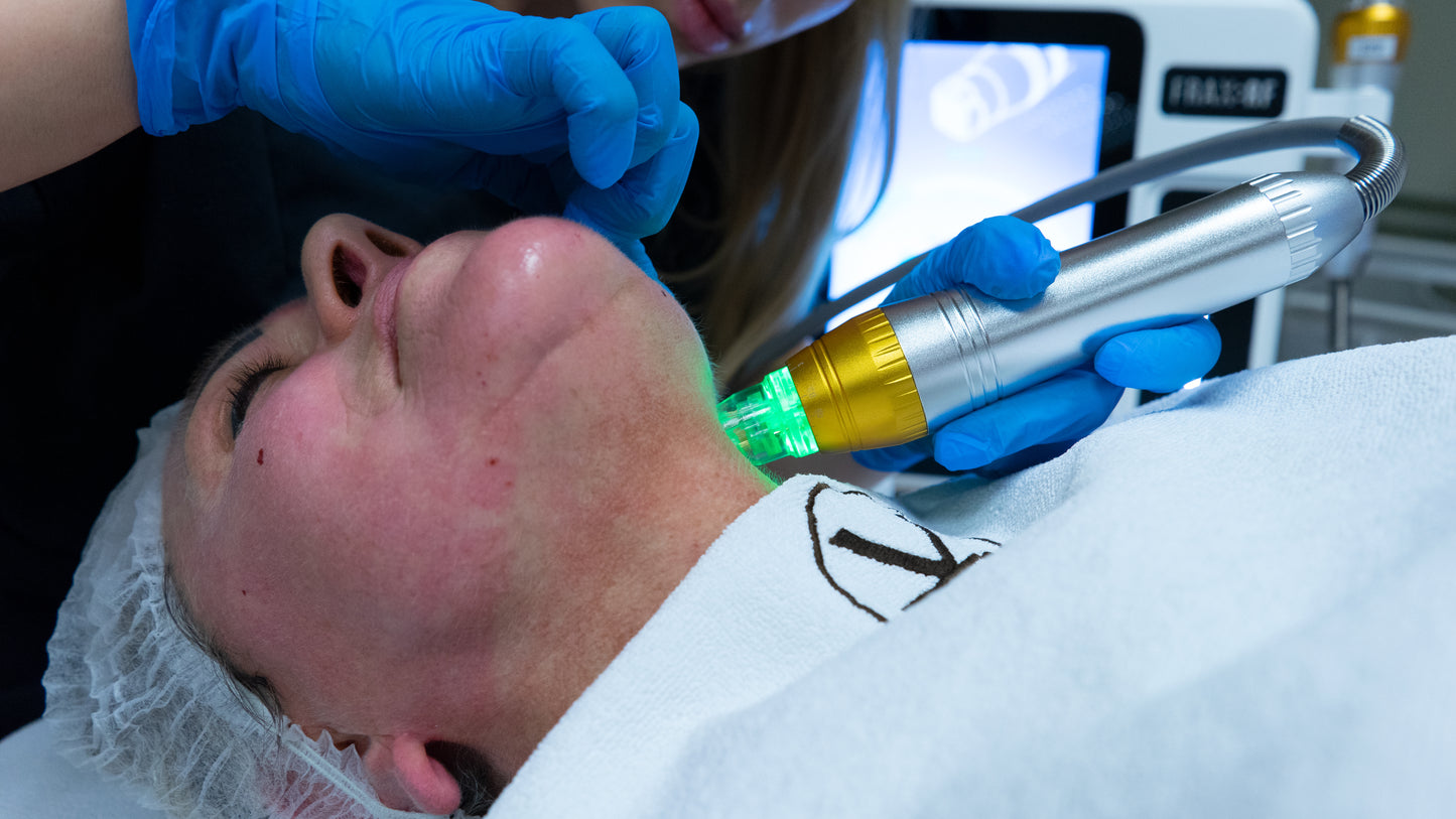 Frax RF – mikronakłucia z falą radiową dla spektakularnego odmłodzenia skóry