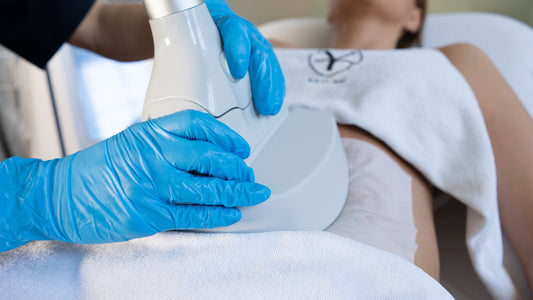 Kriolipoliza - Zabieg Zamrażania Tkanki Tłuszczowej